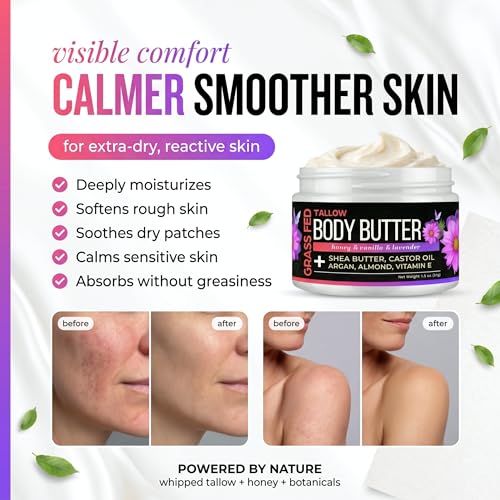 SELFWISE Beef Tallow Body Butter - Hydrating Whipped Balm for Dry Skin