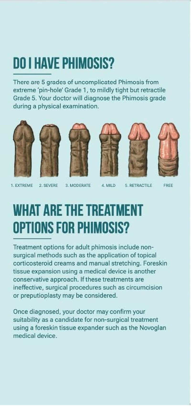 Non-Surgical Phimosis Treatment Kit - Gentle Foreskin Tissue Expander | At-Home Use | Reusable Components