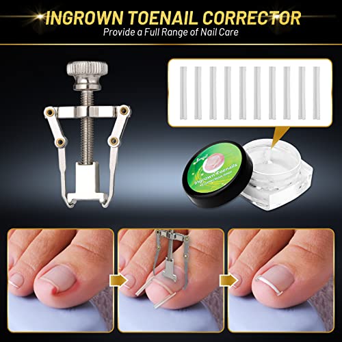 Modacraft 10-Piece Professional Ingrown Toenail Clipper & Pedicure Tool Kit