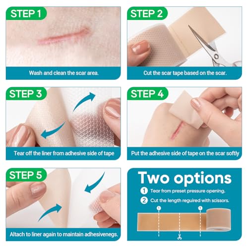 VPRIME SAFETYFY Medical-Grade Silicone Scar Tape 1.6"x 80" Roll-2M for Surgical, C-Section, Acne & Burn Scars