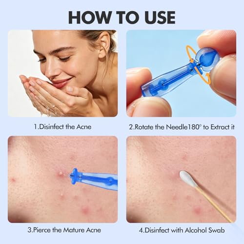 KUMarte 150 PCS Blackhead & Blemish Remover Tool Set for Acne