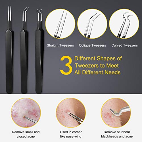 Boxoyx 10-Piece Stainless Steel Pimple Popper & Blackhead Remover Kit