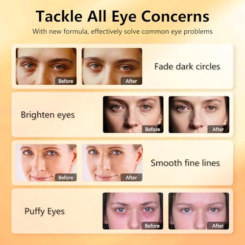 Aeryea 60 Count Vitamin C & Caffeine Under Eye Patches for Dark Circles & Puffiness - Hydrating Collagen Gel Masks for Men & Women
