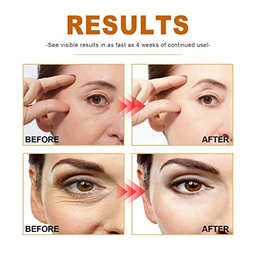Collagen Boost Anti-Aging Serum, Peptide Anti-Wrinkle Face Serum For