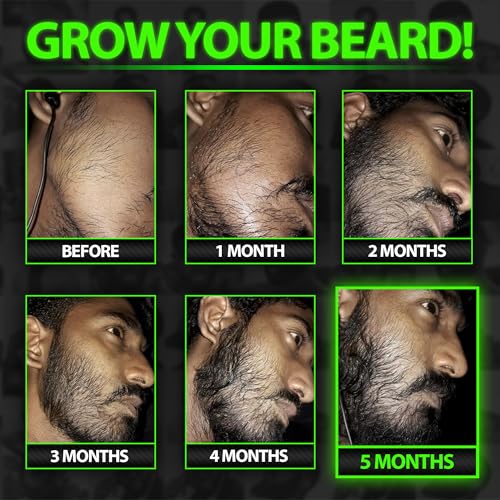 Beard Growth Serum - GROW Maximum XXL Beard Growth Oil for Men -Thickens & Fills Patches - Facial Hair & Scalp Treatment - Beard & Hair Thickening Conditioner & Enhancer