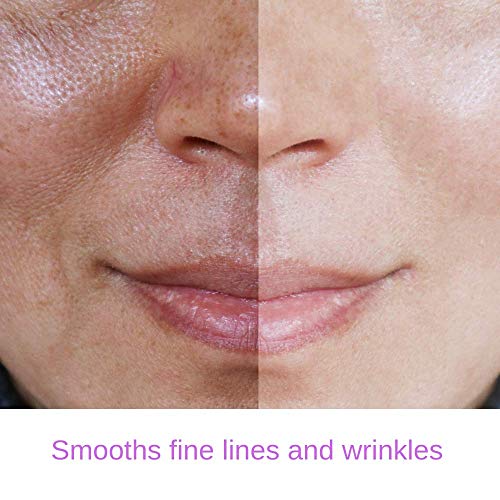 Retinol Serum 2.5% Anti-Aging Face Treatment with Hyaluronic Acid & Vitamin E
