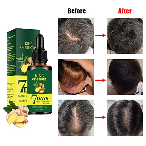 Ginger Hair Growth Oil - 3 Fl Oz (Pack of 3) - Nourishing Serum for Stronger Hair