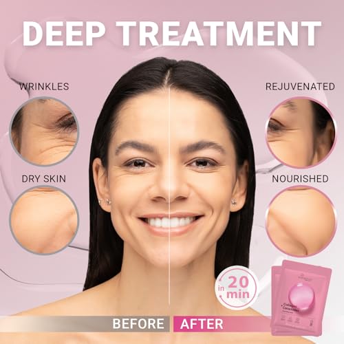 VIABEAUTY 12 Pack Collagen Face Mask with Ceramides - Rejuvenating Sheet Mask for All Skin Types