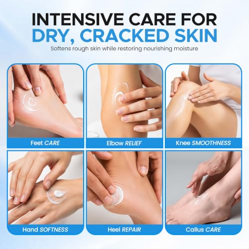 Miratiful 40% Urea Cream with Salicylic Acid for Dry & Rough Skin, Hydrating Foot & Skin Care