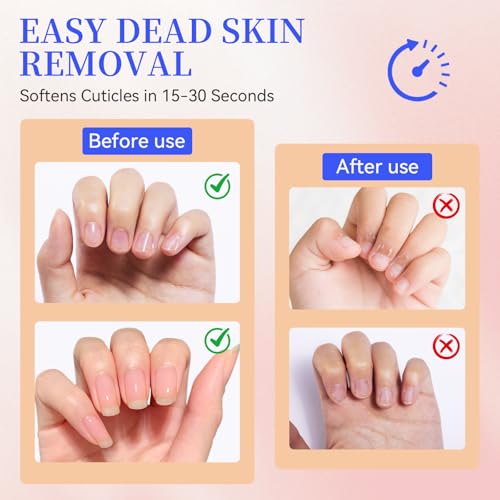 SASSYTIP Cuticle Remover Gel with Jojoba Oil & Vitamin E - 1 fl oz, Clear / Transparent