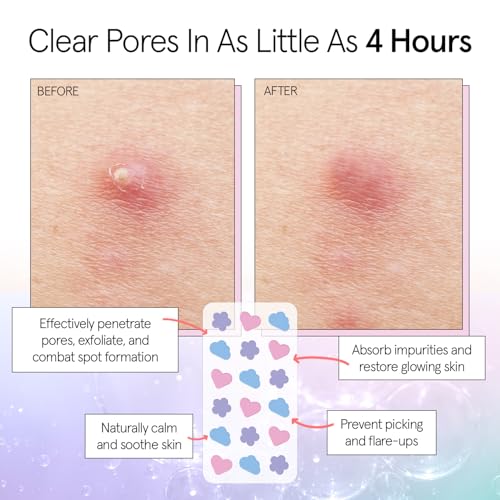 Grace & Stella 72 Pack Award-Winning Clear Pimple Patches with Mirror Case - Acne Spot Treatment