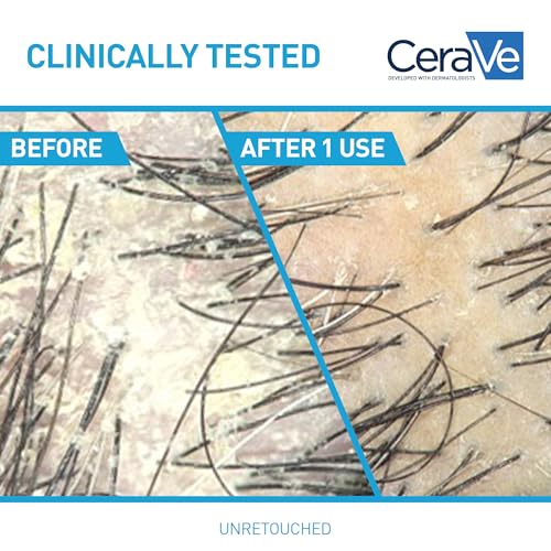 CeraVe Hydrating Anti Dandruff Shampoo, 19 Fl Oz - Itchy Scalp Relief