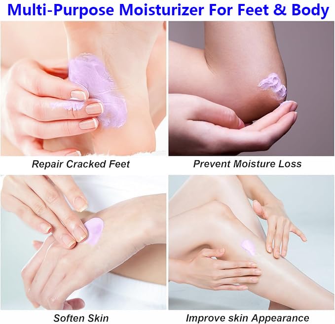 Urea Foot Cream 40% for Cracked Heels – Intensive Moisturizing Lotion 5.29 fl oz