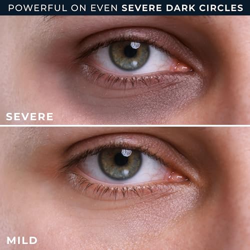 RoC Derm Correxion Retinol Eye Repair Dark Circle Cream Treatment with Niacinamide, Resveratrol, Proxygen for Puffy Eyes, Wrinkles, and Crow's Feet + Line Smoothing Eye Packette