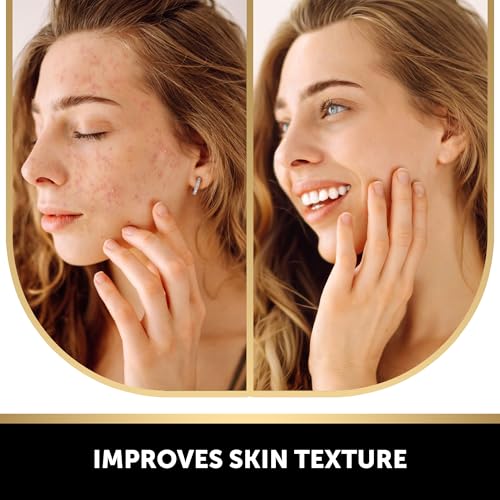 VALITIC Kojic Acid & Turmeric Soap Bars for Dark Spots - 2 Pack with Scrub Bag