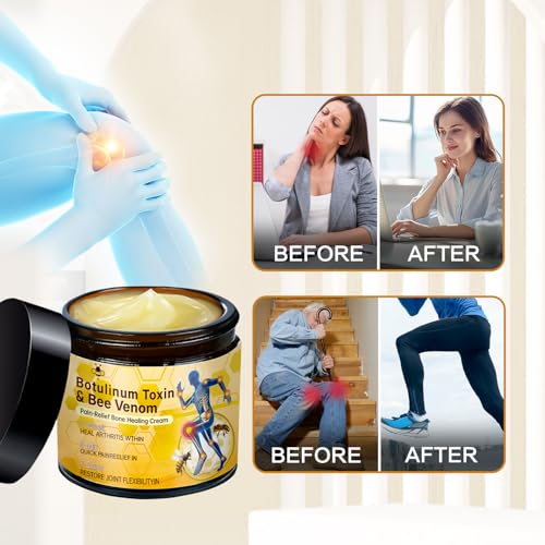 Bee Venom Joint Gel Cream | 2-Pack for Back, Neck & Joints