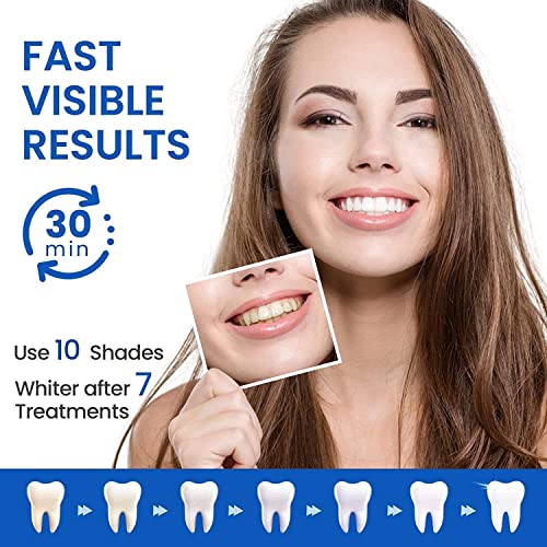 Teeth Whitening Strips - 28 Pcs for Sensitive Teeth - 14 Treatments