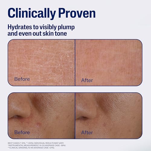 Cetaphil Repair & Renew Night Face Serum 1oz - Sensitive Skin, Vitamin E, Hydrating