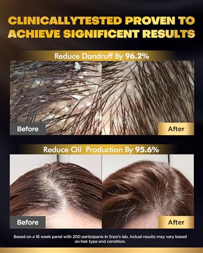 Biotin Hair Growth Shampoo & Conditioner Set for Stronger Hair