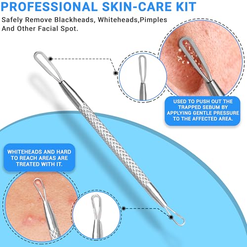 EFAH Care Stainless Steel Pimple Extractor Tool Set - 2 Pcs