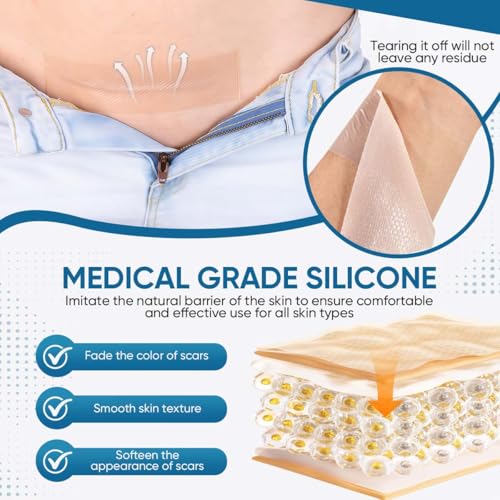 KISEER 2 Rolls Silicone Scar Sheets 1.6 x 60 Inch for Scar & Keloid Removal