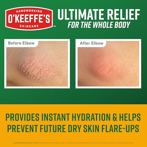 O'Keeffe's Skin Repair Ultimate Relief Body Cream, 7oz Tube