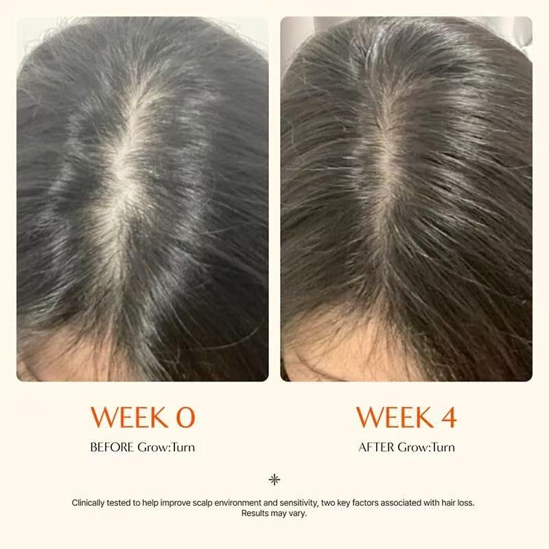 Hair Growth Serum - Scalp Revitalizing with Heartleaf Exosomes & Built-in Applicator Brush | Korean Hair Care Solution