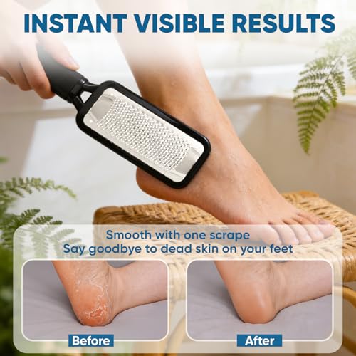 TEAWOO Large Stainless Steel Foot File Callus Remover – Waterproof Pedicure Tool