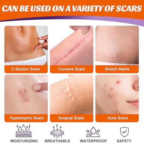 Medical-Grade Silicone Scar Tape for C-Section & Surgical Scars