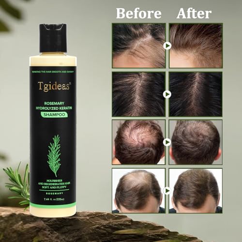 Tgideas Rosemary & Biotin Shampoo for Thinning Hair, Volumizing Shampoo for Fuller, Thicker Hair, Strengthening & Nourishing Formula with Root Lift, Gentle Daily Care for Women & Men (7.4 fl oz)