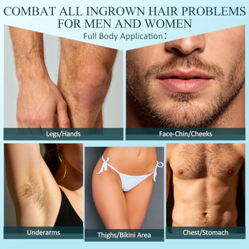 Ingrown Hair Exfoliating Scrub with AHA & BHA - KP Bump Eraser
