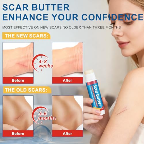 Vopxccvy Scar Butter Stick with Vitamin E, Cocoa & Coconut Oil - 0.7 oz, Moisturizing Skin Balm for Face & Body, Hydrating & Nourishing, Pack of 1