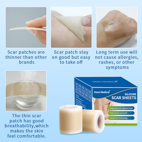 Medical-Grade Silicone Scar Sheets 1.6" x 157" Roll - Keloid, C-Section, Acne Treatment