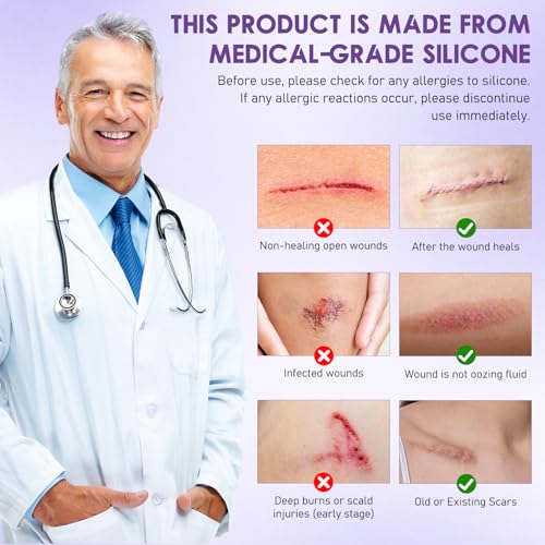 HONGYUNDA 2pcs Silicone Scar Tape for Skin Scar & Wrinkle Reduction