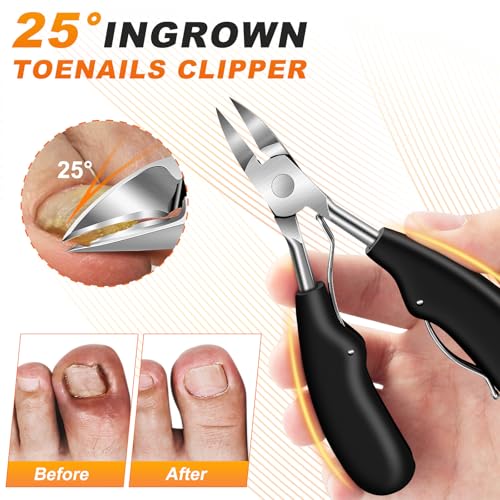 5-Piece Toenail Clipper Set for Thick Nails: Angled, Rotating & Ingrown