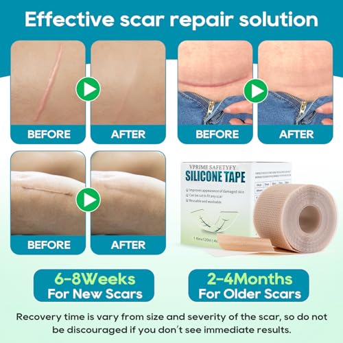 VPRIME SAFETYFY Medical-Grade Silicone Scar Tape 1.6"x 80" Roll-2M for Surgical, C-Section, Acne & Burn Scars
