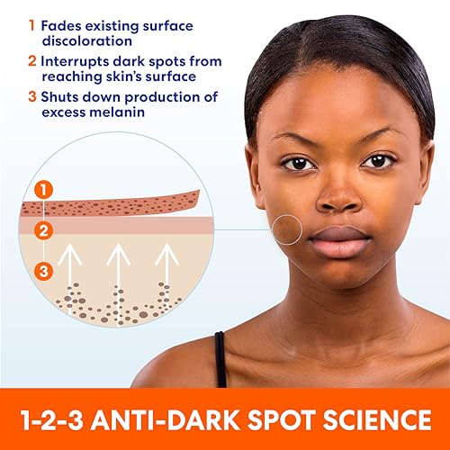 Palmer's Anti Dark Spot Face Cream with Vitamin E & Niacinamide (2.7