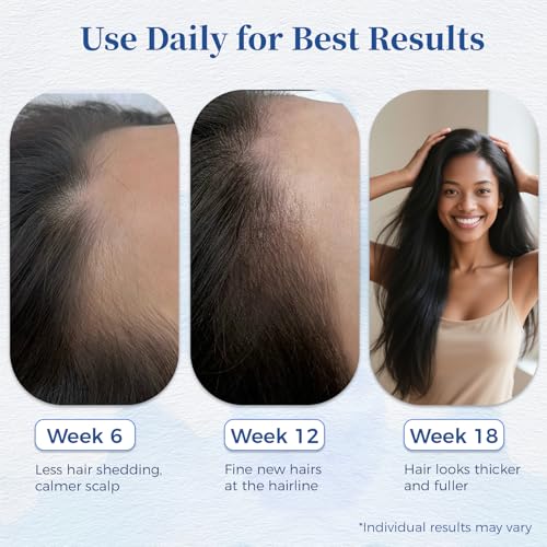 Hair Growth Serum Roll On with Rosemary & Saw Palmetto | 0.84 Fl Oz