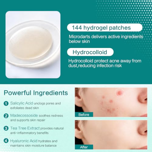 Curalona 2-in-1 Microdart & Hydrocolloid Blemish Patches for Face and Body