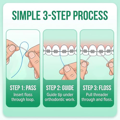 RAZOKO Dental Floss Threaders for Braces & Implants - 140 Count