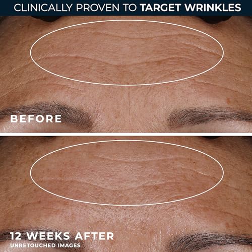 RoC Retinol Correxion Deep Wrinkle Night Cream 0.5oz