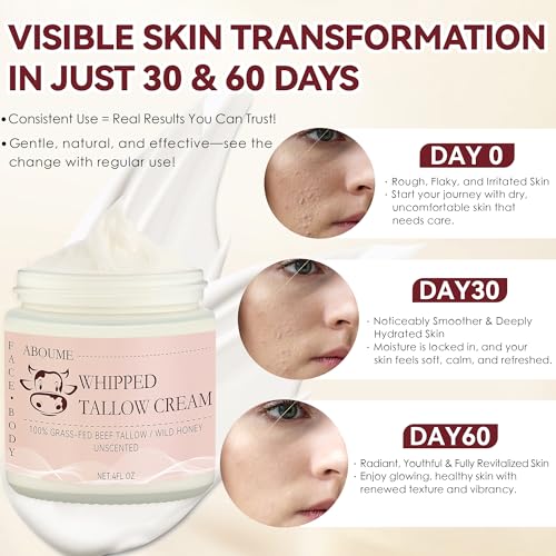 Grass-Fed Beef Tallow & Honey Balm for Sensitive Skin - 4 FL.OZ