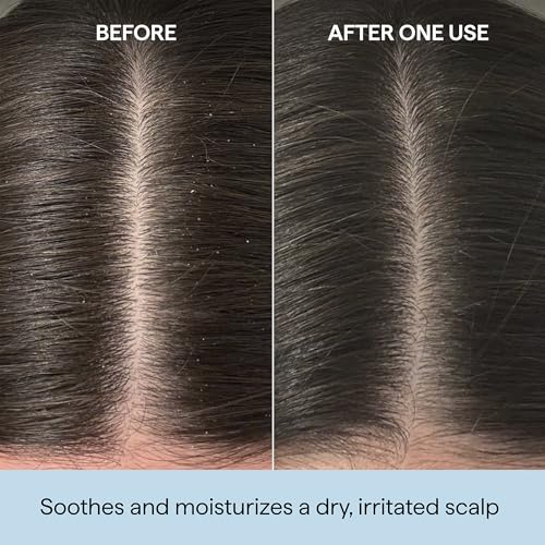 Briogeo Scalp Revival Rosemary Pre-Wash Oil | Moisturizing Scalp Treatment for Dry, Flaky, or Itchy Scalp | Strengthens Hair & Soothes Scalp | Vegan & Cruelty-Free