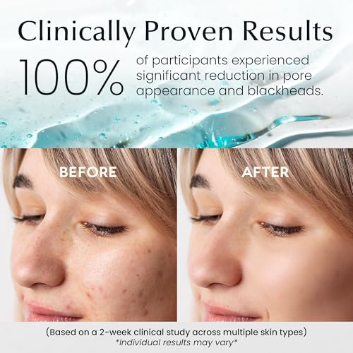 LA PURE Korean Toner Pads for Dark Spots & Dull Skin – 100 Count
