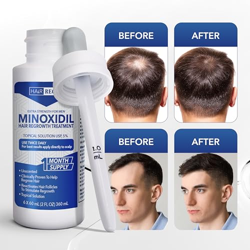 Hair Regen Minoxidil 5% Liquid Solution for Men's Hair Regrowth - 1 Month Supply