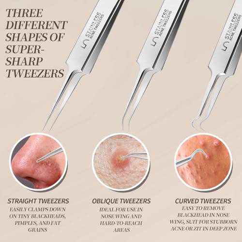 Teenitor Blackhead & Pimple Extractor Tool Kit - Stainless Steel Facial Tweezers & Comedone Removers