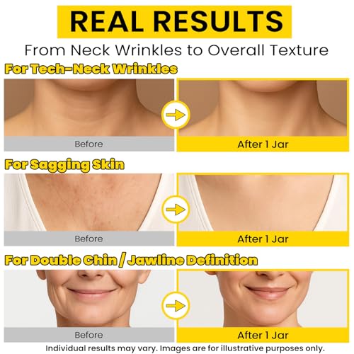 Neck Firming Cream with Collagen, Retinol & Squalane for Men & Women