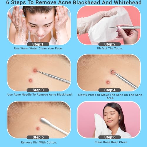 EFAH Care Stainless Steel Pimple Extractor Tool Set - 2 Pcs
