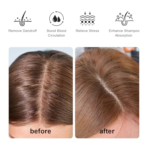 RHOS Scalp Massager Shampoo Brush - Soft Silicone Scrubber for Dandruff