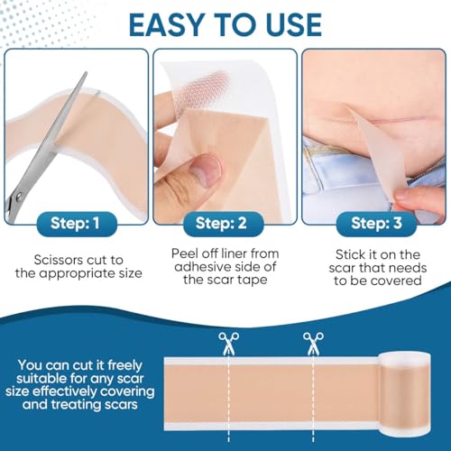KISEER 2 Rolls Silicone Scar Sheets 1.6 x 60 Inch for Scar & Keloid Removal